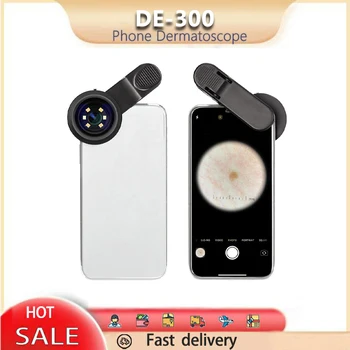 Поляризованный световой кожный Дерматологический Дермаскоп, дерматоскоп для мобильного телефона